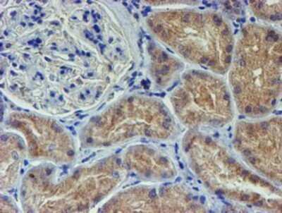 Immunohistochemistry: LECT2 Antibody (OTI2A11) - Azide and BSA Free [NBP2-71122]