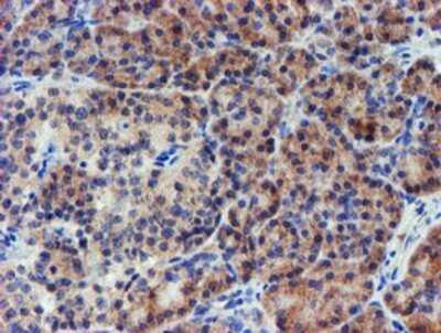 Immunohistochemistry: LECT2 Antibody (OTI2A11) - Azide and BSA Free [NBP2-71122]