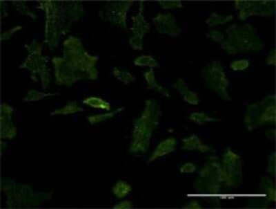Immunocytochemistry/ Immunofluorescence: LEDGF Antibody (1C4) [H00011168-M02]
