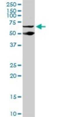 Western Blot: LEDGF Antibody (1C4) [H00011168-M02]