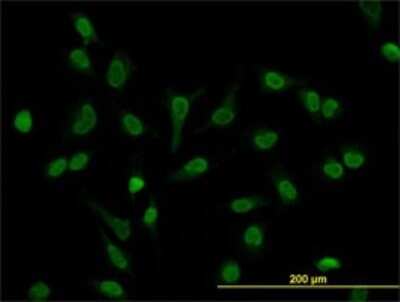 Immunocytochemistry/ Immunofluorescence: LEF1 Antibody (5A3) [H00051176-M03]