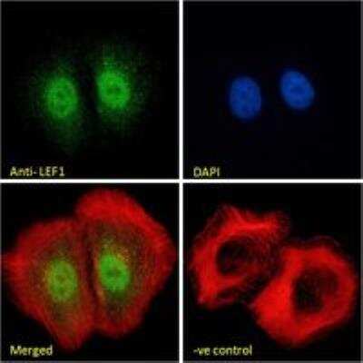 Immunocytochemistry/ Immunofluorescence: LEF1 Antibody [NB100-41374]
