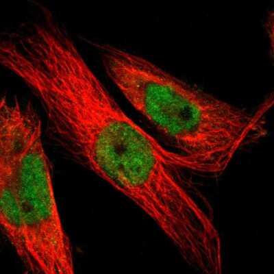 Immunocytochemistry/ Immunofluorescence: LEF1 Antibody [NBP1-86960]
