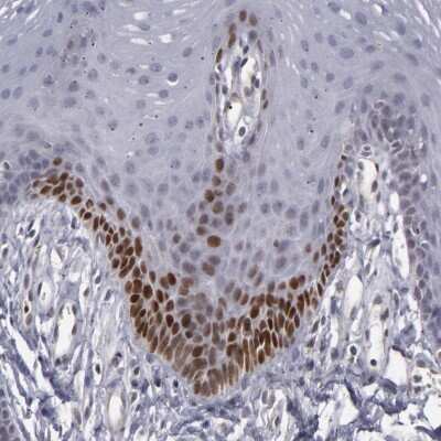 Immunohistochemistry-Paraffin: LEF1 Antibody [NBP1-86960]
