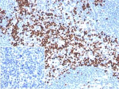 Immunohistochemistry-Paraffin: LEF1 Antibody (LEF1/341R) - Azide and BSA Free [NBP3-08435]