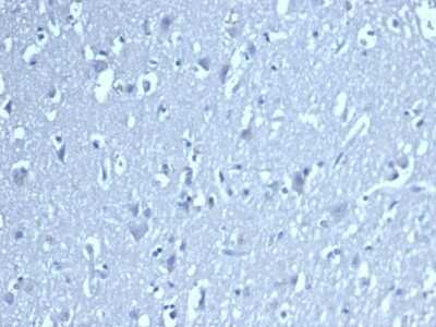 Immunohistochemistry-Paraffin: LEF1 Antibody (LEF1/422R) - Azide and BSA Free [NBP3-08519]
