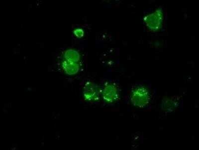 Immunocytochemistry/ Immunofluorescence: LEMD3 Antibody (OTI6C10) - Azide and BSA Free [NBP2-71744]