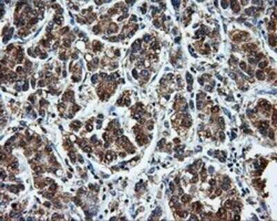 Immunohistochemistry: LEMD3 Antibody (OTI6C10) - Azide and BSA Free [NBP2-71744]