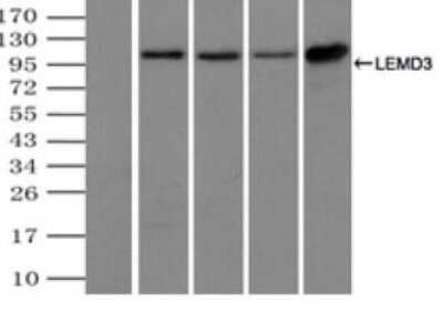 Immunoprecipitation: LEMD3 Antibody (OTI6C10) - Azide and BSA Free [NBP2-71744]