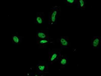Immunocytochemistry/ Immunofluorescence: LENG1 Antibody (OTI10A7) - Azide and BSA Free [NBP2-72202]