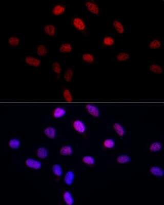 Immunocytochemistry/ Immunofluorescence: LEO1 Antibody - Azide and BSA Free [NBP3-16704]