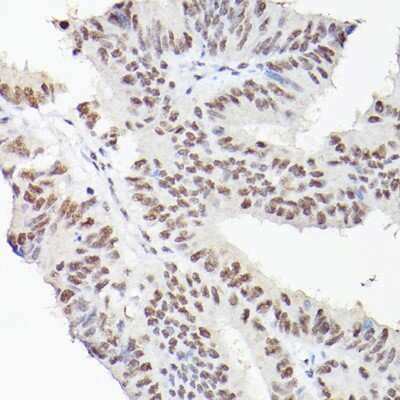 Immunohistochemistry-Paraffin: LEO1 Antibody - Azide and BSA Free [NBP3-16704]