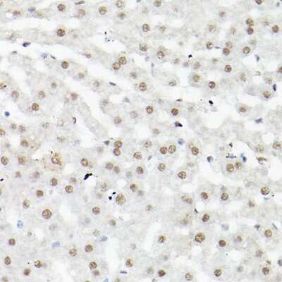 Immunohistochemistry-Paraffin: LEO1 Antibody - Azide and BSA Free [NBP3-16704]
