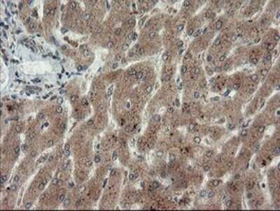 Immunohistochemistry: LEPRE1 Antibody (OTI1H3) [NBP2-45786]