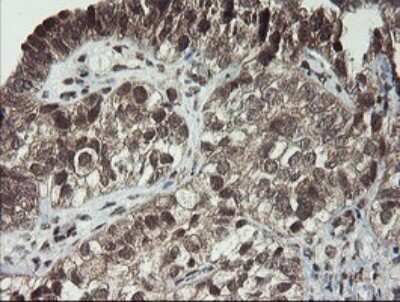 Immunohistochemistry: LEPRE1 Antibody (OTI1H3) [NBP2-45786]