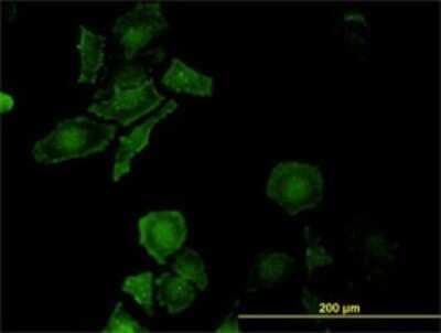 Immunocytochemistry/ Immunofluorescence: LEPRE1 Antibody (3C7) [H00064175-M01]
