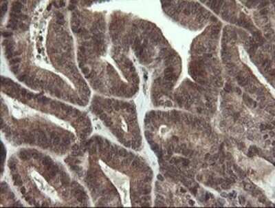 Immunohistochemistry: LEPRE1 Antibody (OTI1H3) - Azide and BSA Free [NBP2-72134]