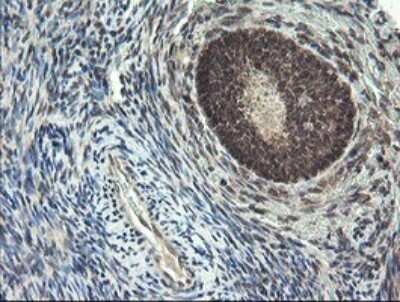 Immunohistochemistry: LEPRE1 Antibody (OTI1H3) - Azide and BSA Free [NBP2-72134]