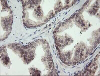 Immunohistochemistry: LEPRE1 Antibody (OTI1H3) - Azide and BSA Free [NBP2-72134]