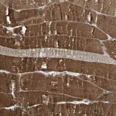 Immunohistochemistry-Paraffin: LEPREL1 Antibody [NBP1-94041]