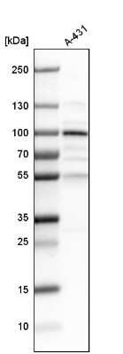 Western Blot: LEPREL1 Antibody [NBP1-94041]