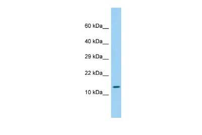 Western Blot: LEPROTL1 Antibody [NBP2-83143]