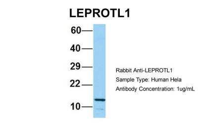Western Blot: LEPROTL1 Antibody [NBP2-83143]