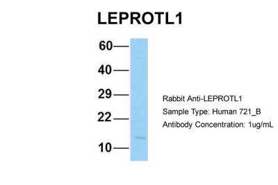 Western Blot: LEPROTL1 Antibody [NBP2-83143]