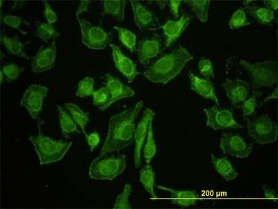 Immunocytochemistry/ Immunofluorescence: LETM1 Antibody (6F7) [H00003954-M03]