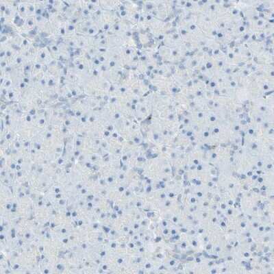 Immunohistochemistry-Paraffin: LETM1 Antibody [NBP1-86482]
