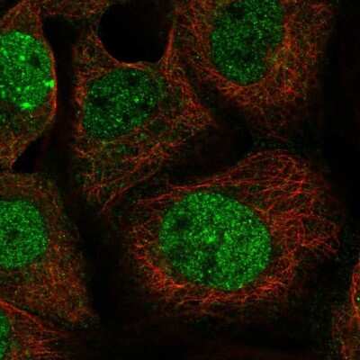 Immunocytochemistry/ Immunofluorescence: LETM2 Antibody [NBP1-83563]