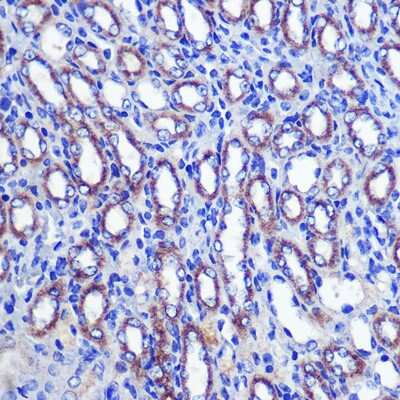 Immunohistochemistry-Paraffin: LETMD1 Antibody - BSA Free [NBP3-04759]