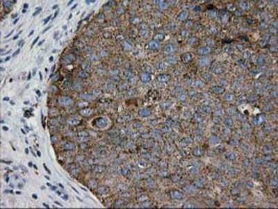 Immunohistochemistry-Paraffin: Galectin-3BP/MAC-2BP/LGALS3BP Antibody (OTI6B7) [NBP2-01160]