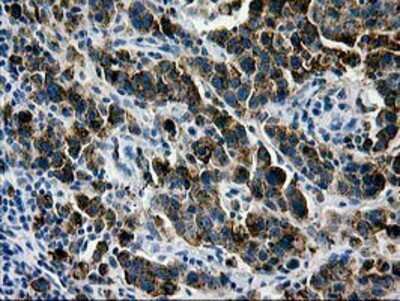 Immunohistochemistry-Paraffin: Galectin-3BP/MAC-2BP/LGALS3BP Antibody (OTI6B7) [NBP2-01160]