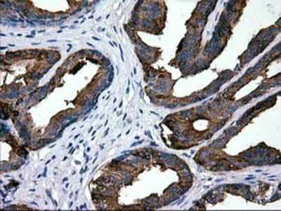 Immunohistochemistry-Paraffin: Galectin-3BP/MAC-2BP/LGALS3BP Antibody (OTI6B7) [NBP2-01160]