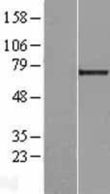 Western Blot: Galectin-3BP/MAC-2BP/LGALS3BP Overexpression Lysate [NBL1-12502]