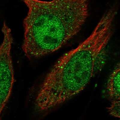 Immunocytochemistry/ Immunofluorescence: LGSN Antibody [NBP2-58511]
