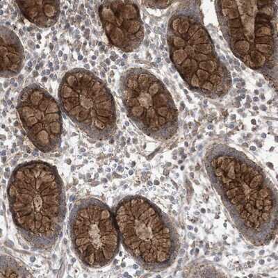 Immunohistochemistry-Paraffin: LGSN Antibody [NBP1-93715]