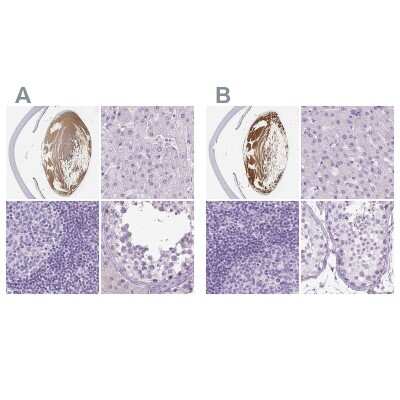 Immunohistochemistry-Paraffin: LGSN Antibody [NBP1-93715]