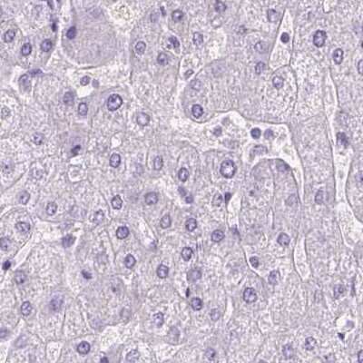 Immunohistochemistry-Paraffin: LGSN Antibody [NBP1-93715]