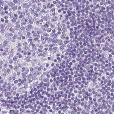 Immunohistochemistry-Paraffin: LGSN Antibody [NBP1-93715]