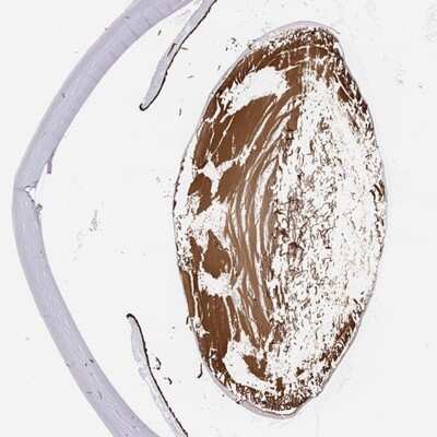 Immunohistochemistry-Paraffin: LGSN Antibody [NBP2-58511]