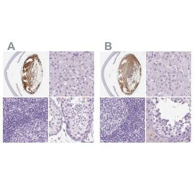Immunohistochemistry-Paraffin: LGSN Antibody [NBP2-58511]