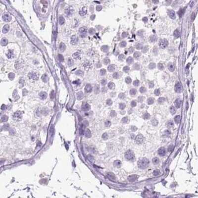 Immunohistochemistry-Paraffin: LGSN Antibody [NBP2-58511]