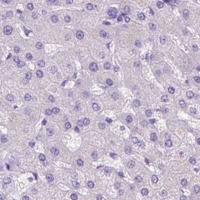 Immunohistochemistry-Paraffin: LGSN Antibody [NBP2-58511]