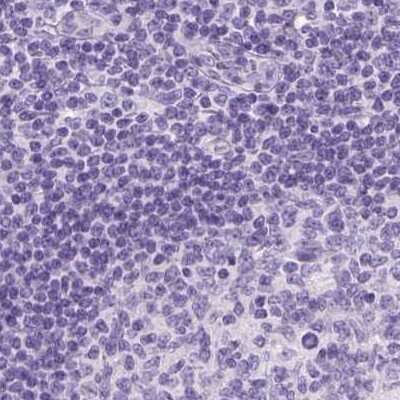 Immunohistochemistry-Paraffin: LGSN Antibody [NBP2-58511]