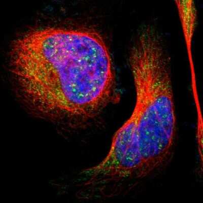 Immunocytochemistry/ Immunofluorescence: LHPP Antibody [NBP1-83272]