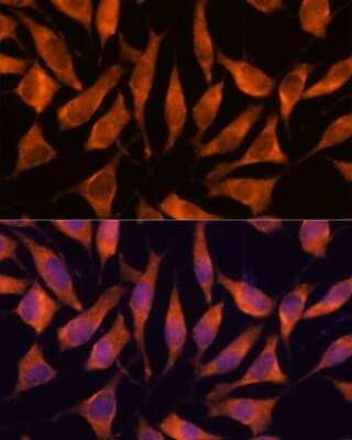 Immunocytochemistry/ Immunofluorescence: LHPP Antibody - Azide and BSA Free [NBP3-04615]