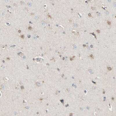 Immunohistochemistry-Paraffin: LHPP Antibody [NBP1-83272]