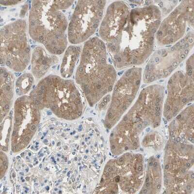Immunohistochemistry-Paraffin: LHPP Antibody [NBP1-83272]